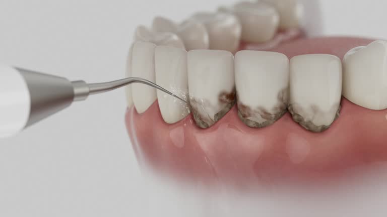 Trusted Tooth Extraction service in Rossville, TN - Dentist Open Now